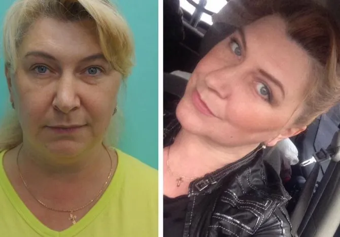 Екатерина Соколова Волкова фото до и после