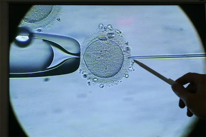 Сколько стоит сперма. Яйцеклетка под микроскопом. Фото.