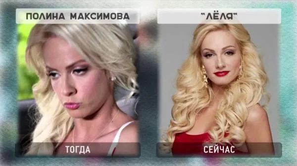 Полина Максимова до и после пластики