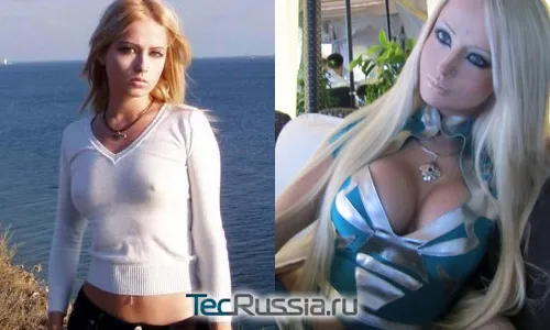 Валерия Лукьянова – фото до и после пластической операции