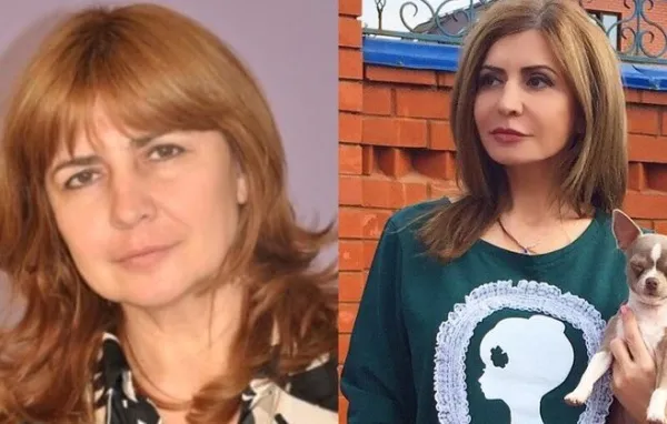 Ирина Агибалова. Фото до и после операции, похудения
