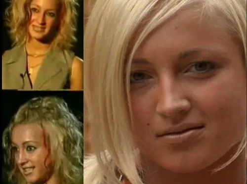 Ольга Бузова - фото до и после пластики носа, губ, скул. Как похудела, какие пластические операции делала
