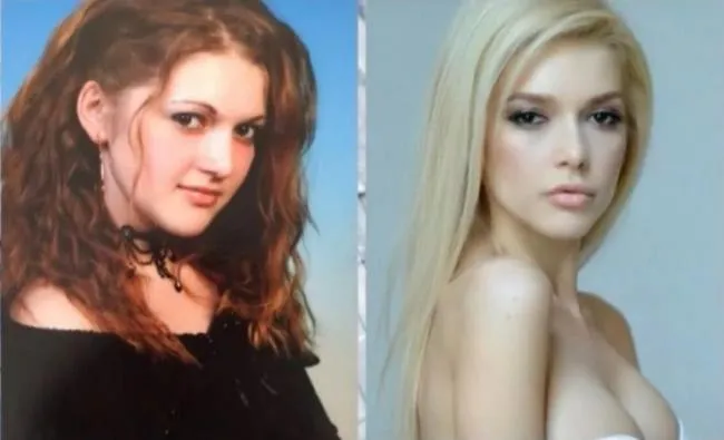 Эрика до и после похудения