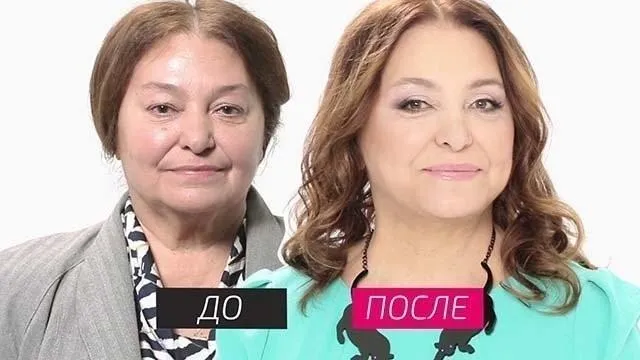 Наталья Бондарчук до и после пластики