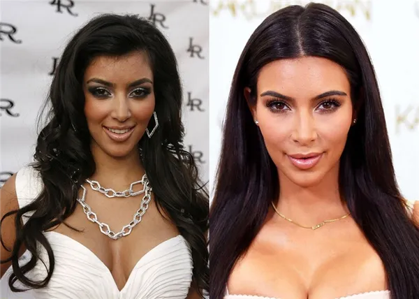 Ким Кардашьян до и после пластики