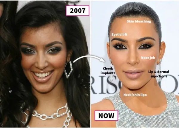 Ким Кардашьян до пластики в 2007 году и после