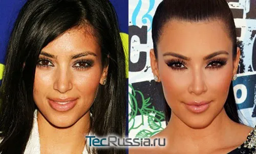 Ким Кардашян – фото до и после пластических операций
