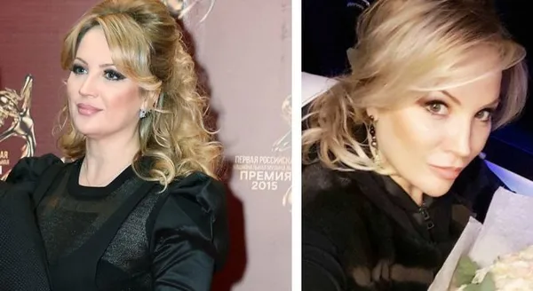Жена Стаса Михайлова до и после пластики