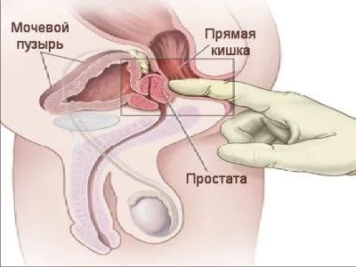 техника массаж простаты